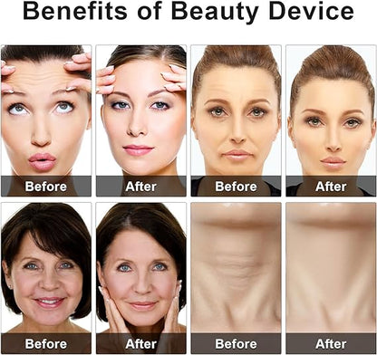 Eye Beauty Device | جهاز العناية بجمال العين والبشرة